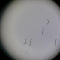 C.elegans project thumbnail