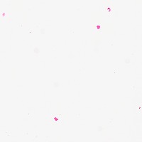 inflammation-1 project thumbnail