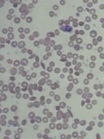red-blood-cells project thumbnail