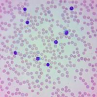 White Blood Cell Detect project thumbnail