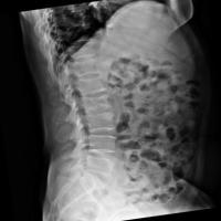 spinefrxnormalvindr-qget project thumbnail