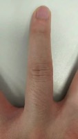 Finger Segmentation project thumbnail