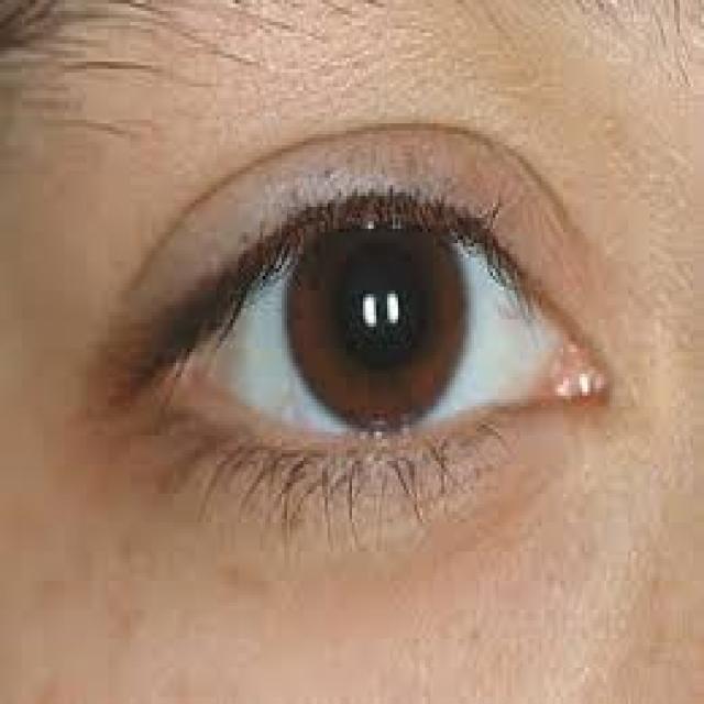 eye normal eye Object Detection Dataset by Sona college of technology