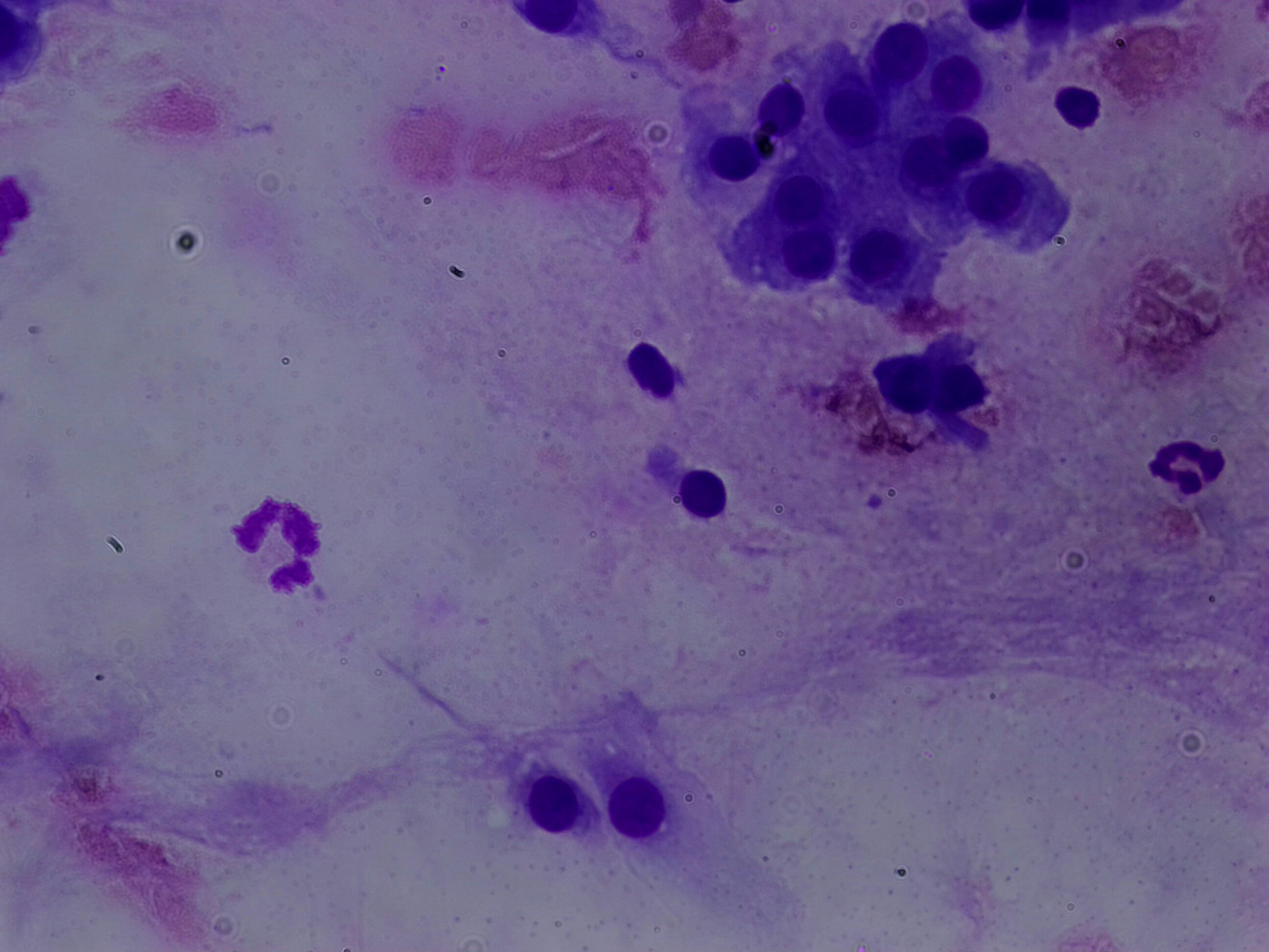 Yolo V11 Instance Segmentation Original 2025 03 Instance