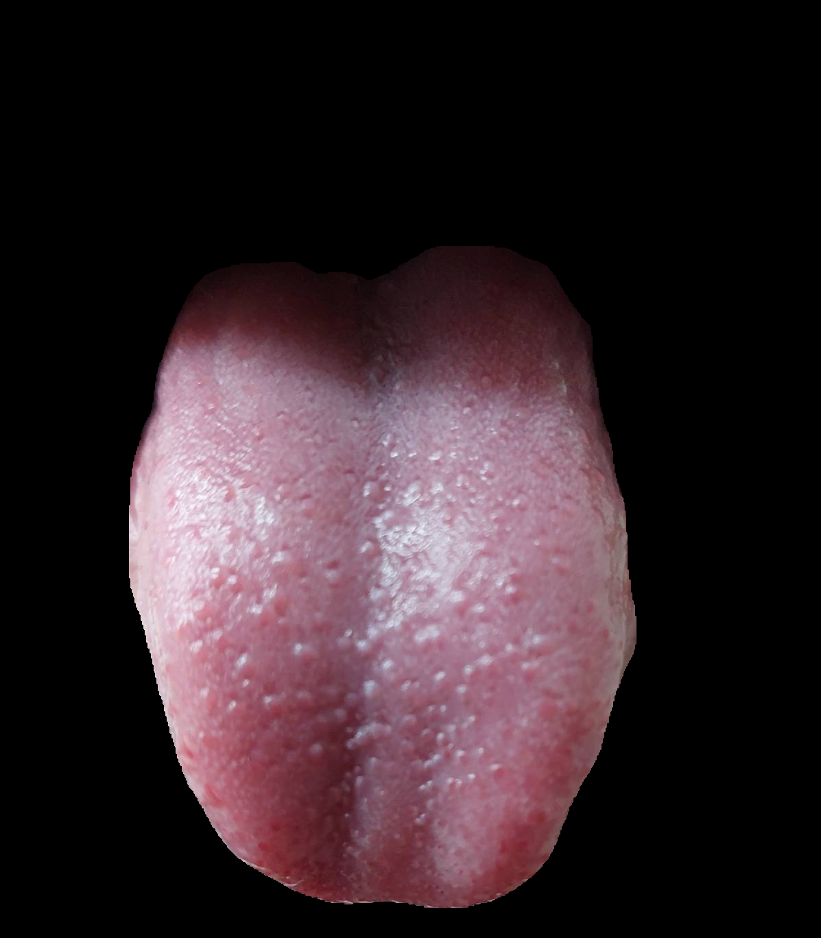 tongue-coating-color-object-detection-dataset-by-tongue