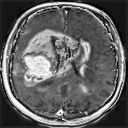 Brain Tumor project thumbnail