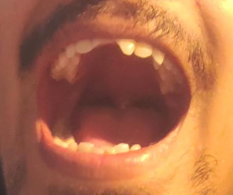 Shakar otasi bilan porno tomosha qiling Chiroyli ichki kiyimdagi qizlarning fotosuratlari