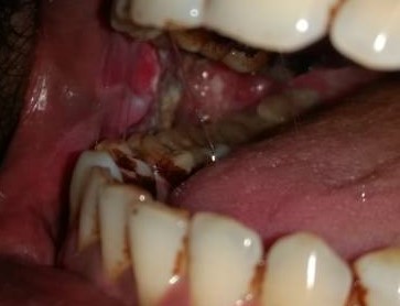 Rus ayol jinsiy aloqada boladi Porno video veb-kamera oral seks