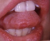 Tongue Check project thumbnail
