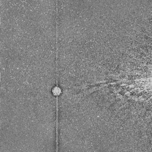nuse Instance Segmentation Model by NEO