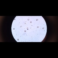 urchin project thumbnail
