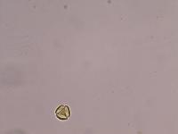 pol_id_detection project thumbnail