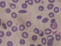 SCA Types identification project thumbnail