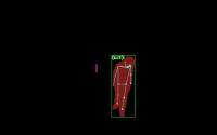 Shoplifting Detection Retail project thumbnail