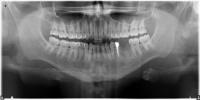 Healthy Tooth project thumbnail