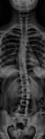 spine(4, 8,8) project thumbnail