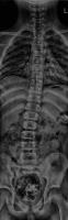 spine(4, 16,16) project thumbnail