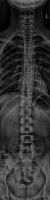 spine(3, 16,16) project thumbnail