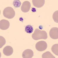 Blood-Cell project thumbnail