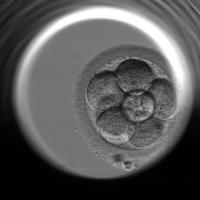 cell detection project thumbnail