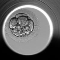 embryo segmentation project thumbnail