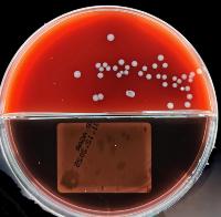 Bacterial Detection project thumbnail