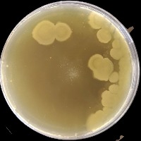 Bacterial Classification project thumbnail