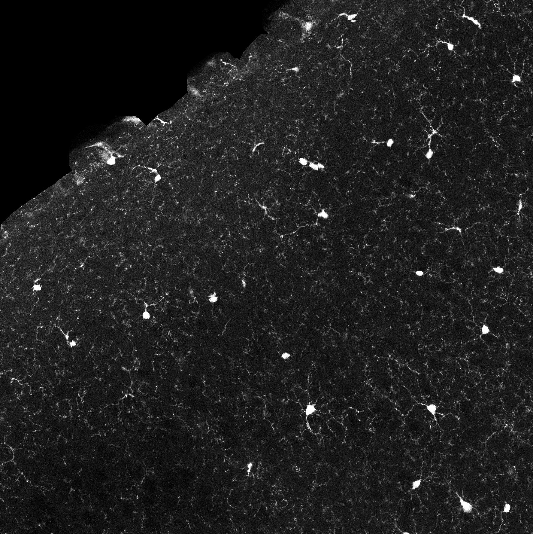 Tissue Side Project Test Instance Segmentation Dataset by Test
