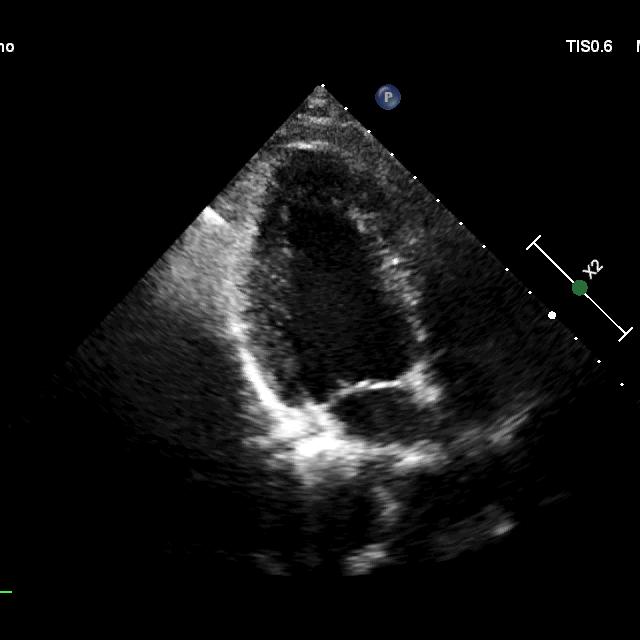 Heart Instance Segmentation Instance Segmentation Model by Test