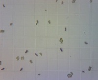 Dataset x100 project thumbnail