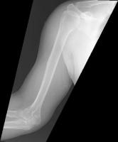 bone project thumbnail