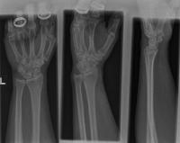 bone project thumbnail