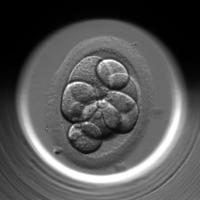 IVF project thumbnail