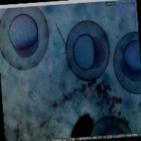 ZebraFish project thumbnail