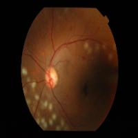 DR detection project thumbnail