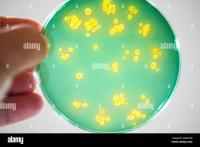 vibrio stains project thumbnail