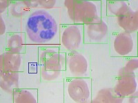 bccd project thumbnail