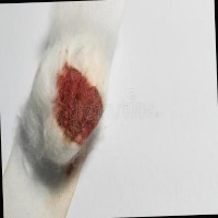 medical waste project thumbnail