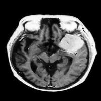Test_model_for_medical_education project thumbnail