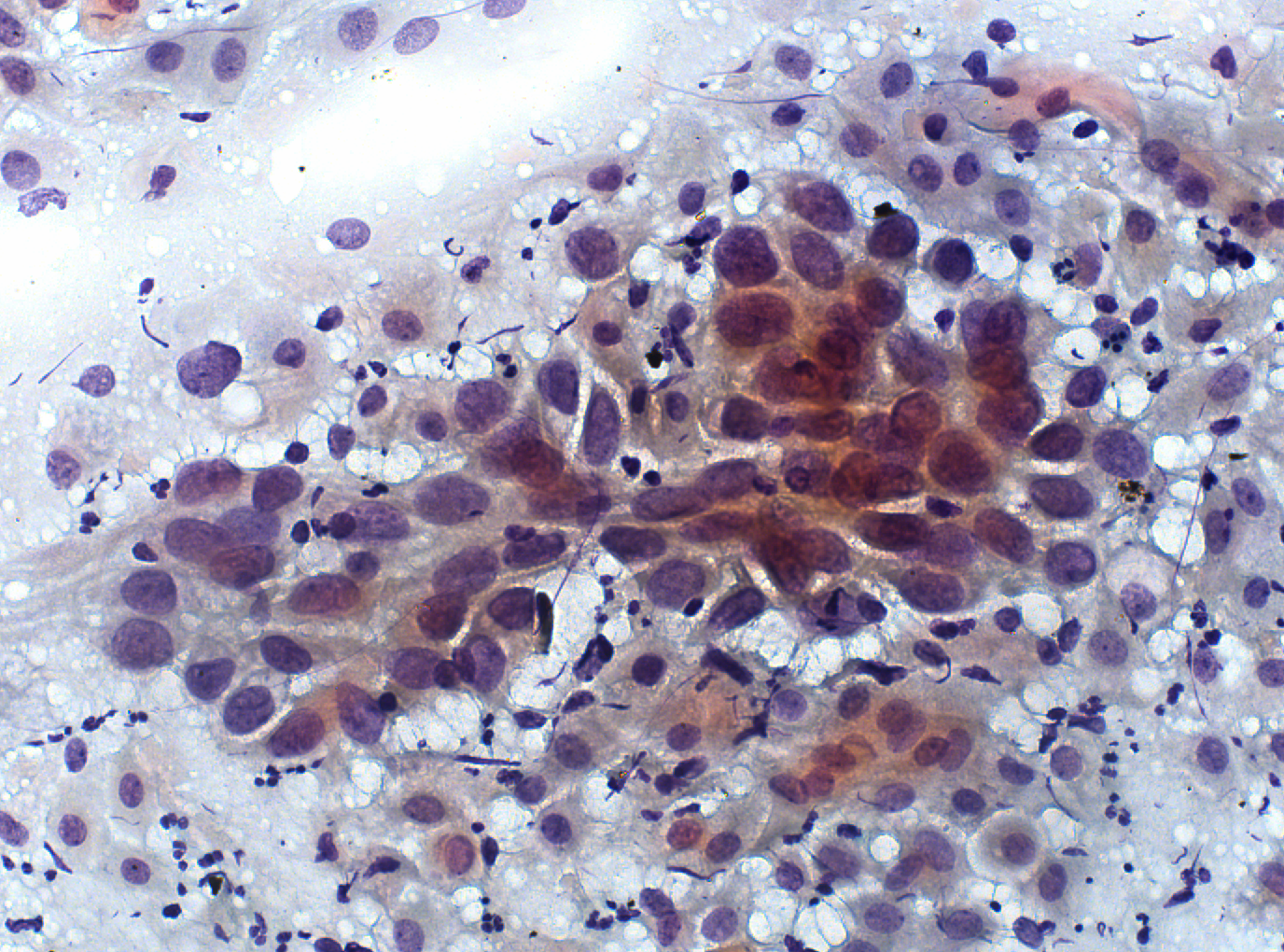 ASC-H Object Detection Dataset by Cervical Cancer