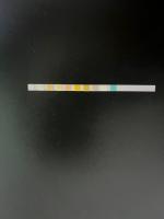 UrineStrip project thumbnail