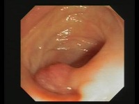 polyps-batch-8 project thumbnail