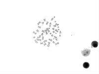 DETECTION CHROMOSOMES BANDE R project thumbnail