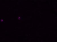 TILs Identification project thumbnail