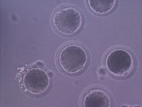 COC Segmentation project thumbnail