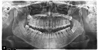 segmentation project thumbnail