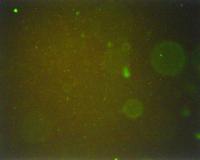 LDM Cell Detection project thumbnail