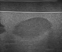 PRONOBIS_urethra_seg project thumbnail