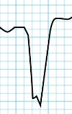 baseecg project thumbnail