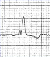ECG project thumbnail